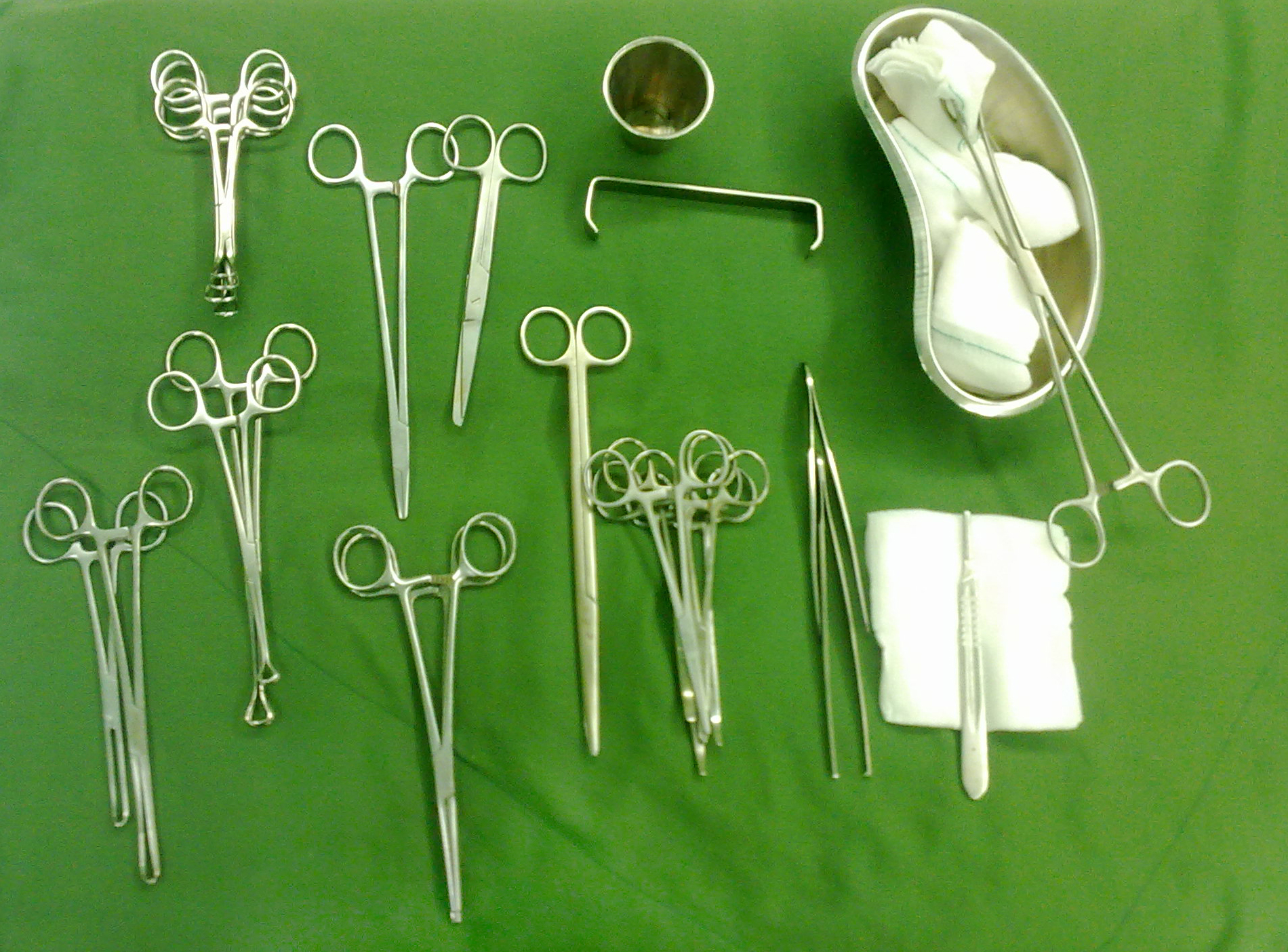 Esterilización tubárica